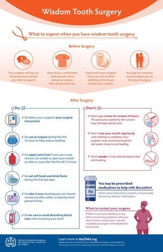 wisdom_teeth_surgery_infographic-tile
